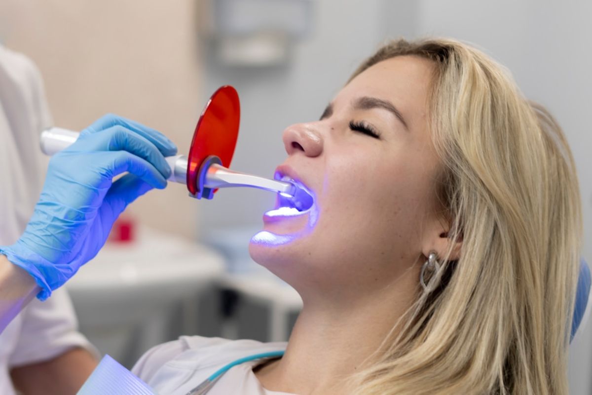 Teeth Whitening Mesa