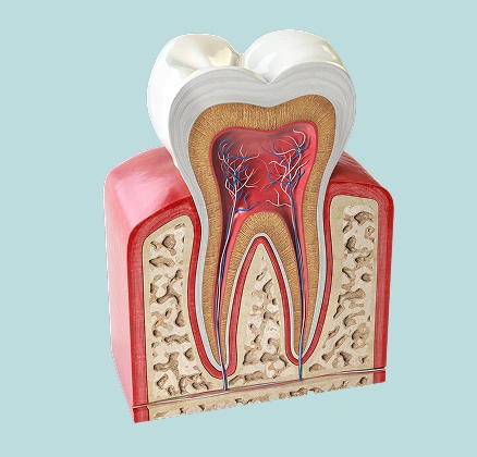Anatomical dental model showing tooth cross-section with pulp chamber, roots, and surrounding gum tissue structure.