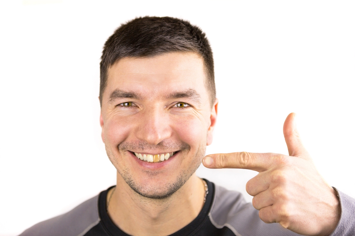 Why is Only One of My Teeth Discolored Causes and Solutions in Mesa