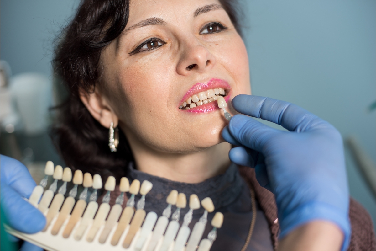 Are Porcelain Veneers Permanent? Find Out from Our Cosmetic Dentist